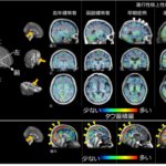運動や認知機能が急速に低下する神経難病の原因を解明