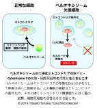 細胞内小器官ペルオキシソームの新たな機能を発見