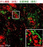 がんに自律神経が影響することを発見