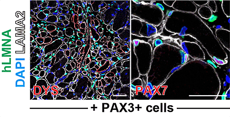 ダイレクトリプログラミング技術によるヒト骨格筋幹細胞の作成に成功