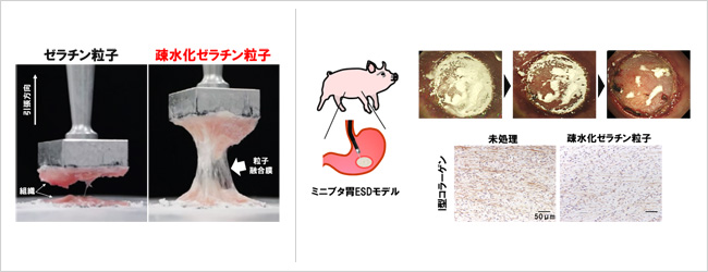 がん手術後の炎症を抑える粒子状の被覆材を開発