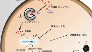 慢性閉塞性肺疾患：COPD（タバコ病）に、有害な鉄による脂質酸化依存的細胞死が深く関与…
