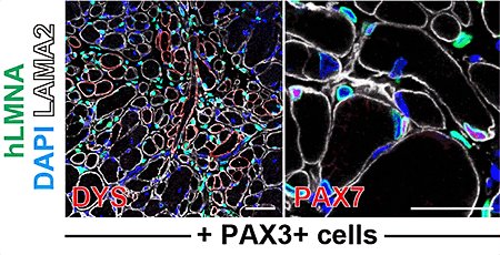 ダイレクトリプログラミング技術によるヒト骨格筋幹細胞の作成に成功