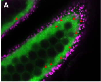 イネの花粉形成を司る葯タペート細胞でオートファジーの可視化に成功