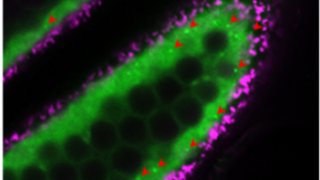 イネの花粉形成を司る葯タペート細胞でオートファジーの可視化に成功