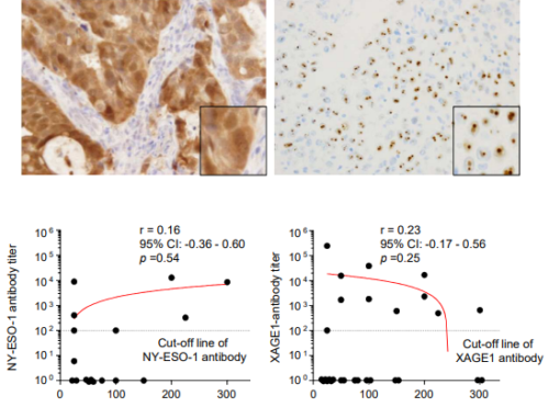 肺がん免疫チェックポイント療法の効果を予測するバイオマーカーを発見