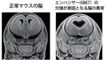 ヒト先天異常「全前脳胞症」の発症にかかわる制御配列を発見 ヒト先天異常「全前脳胞症」の発症にかかわる制御配列を発見