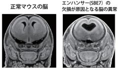 ヒト先天異常「全前脳胞症」の発症にかかわる制御配列を発見