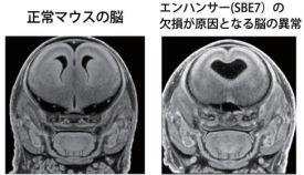 ヒト先天異常「全前脳胞症」の発症にかかわる制御配列を発見