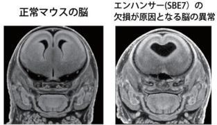 ヒト先天異常「全前脳胞症」の発症にかかわる制御配列を発見