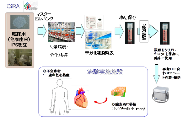 iPS細胞から作製した心筋細胞シートの医師主導治験の実施～重症心筋症の治療に向けて～