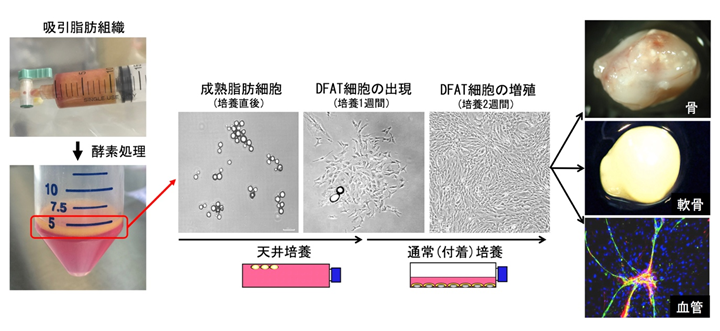 患者自身の脂肪細胞から作られる「DFAT細胞」を用いて世界初の血管再生医療の臨床研究を開始