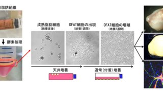 患者自身の脂肪細胞から作られる「DFAT細胞」を用いて世界初の血管再生医療の臨床研究を開始