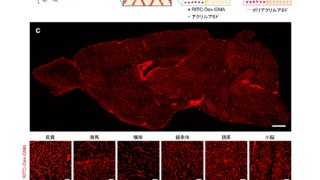 全脳血管ネットワーク可視化に成功～機能的MRI信号解読への一助～