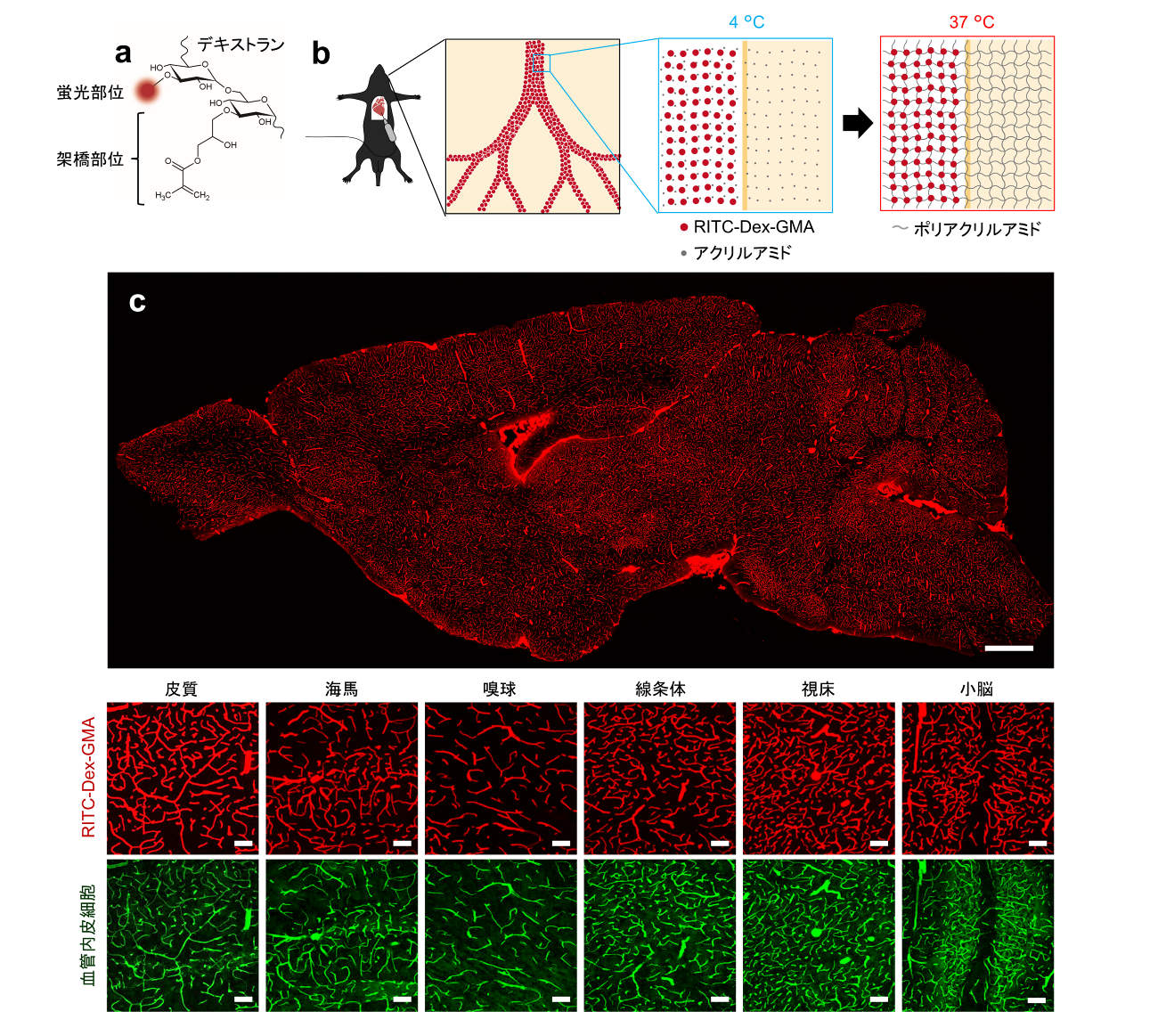 全脳血管ネットワーク可視化に成功～機能的MRI信号解読への一助～