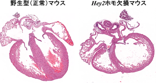 胎児心不全に対する新規治療法開発につながる可能性
