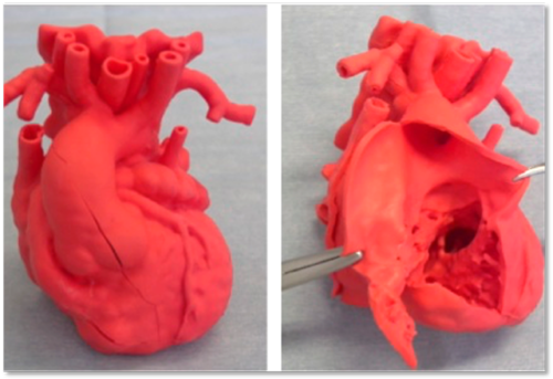 立体構造が複雑な先天性心疾患の手術支援を目指す「超軟質実物大3D心臓モデル」の有用性検証試験…