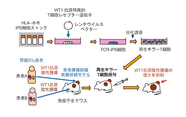 ヒトiPS細胞から再生したキラーT細胞の固形がんモデルにおける治療効果を確認