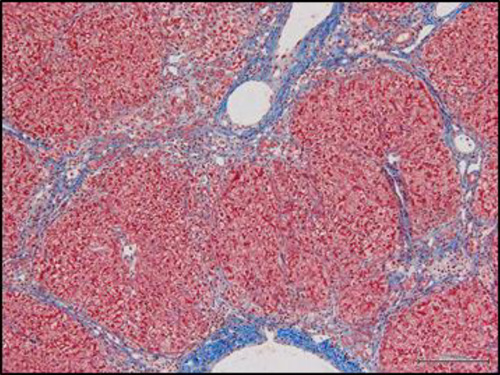 肝硬変に対する細胞療法の確立のための非ヒト霊長類肝線維症モデルの開発