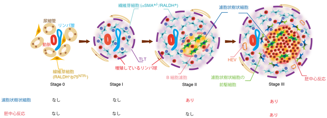 腎臓病の予後を予測する新規障害マーカーの発見～腎障害と共に三次リンパ組織は成熟する～