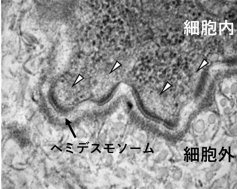遺伝性神経疾患における病態多様性のメカニズムを解明~神経症状と皮膚症状を合併する遺伝病の発症機序