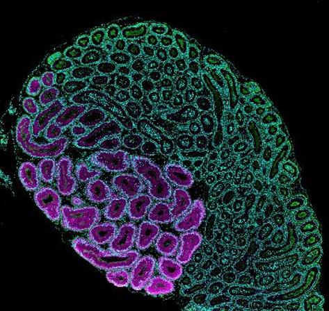 精子の成熟を調節する鍵分子を発見～不妊症の原因究明と治療に新たな視点～