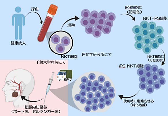 世界初、iPS-NKT細胞を血管内に直接投与～頭頸部がんの免疫細胞療法で治験を開始～