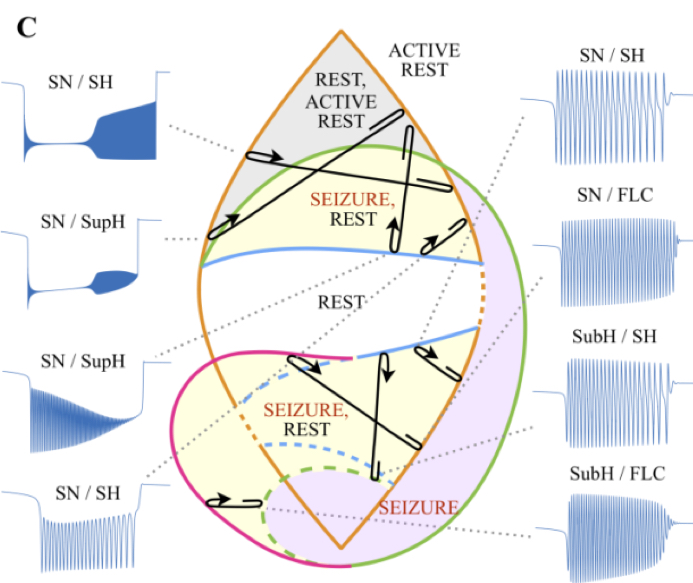 複雑なてんかん発作を新規の数学モデルにより分類～理論と臨床が一致～