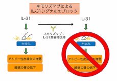 かゆみを標的にしたアトピー性皮膚炎の新規治療薬の有効性を確認