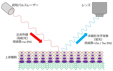 “光生検”切らずにその場でがんをすぐ診断―イメージングで組織を傷つけずに立体観察、AIが自動診断―