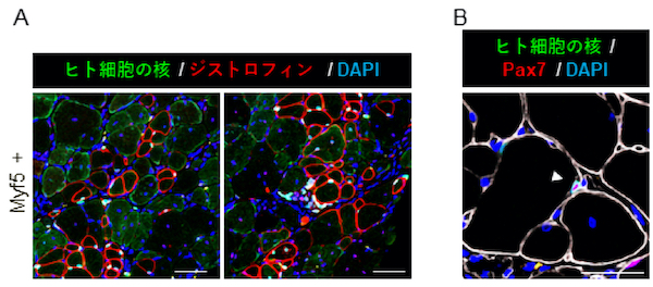 筋ジストロフィーモデルマウスにおけるヒトiPS細胞由来骨格筋幹細胞の移植効果を確認