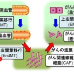 腫瘍組織における血管内皮細胞からの因子により、がんが進展するしくみを解明