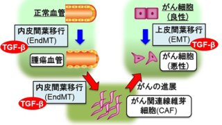 腫瘍組織における血管内皮細胞からの因子により、がんが進展するしくみを解明
