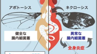 全身炎症を蔓延させる、腸内フローラの知られざる影響