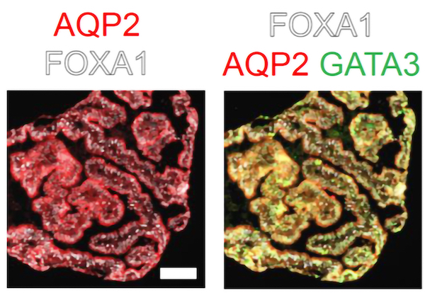 腎集合管のもとになる組織を大量に作製することに成功