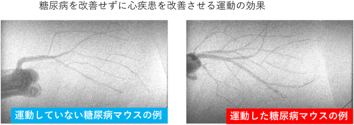 糖尿病の発症初期段階での運動はマイクロRNAの発現増加と心機能の改善をもたらすことが明らかに