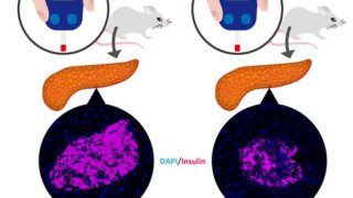 mRNA分解を制御するタンパク質と糖尿病との驚くべき関係