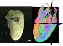 ヒト胎児心臓の心筋線維方向を追跡 ～受精後8週の心筋線維は成人と同じ配列をする～