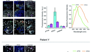 インスリンのアミロイド形成および毒性多型を明らかに