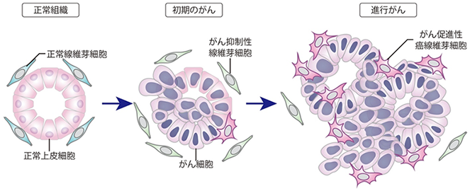 大腸がん細胞の周囲で増える正常細胞の多様性を解明 | テック・アイ生命科学