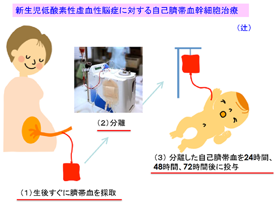 脳性まひ予防に向けて~低酸素性虚血性脳症に対する自己さい帯血幹細胞治療第Ⅱ相試験開始のお知らせ~