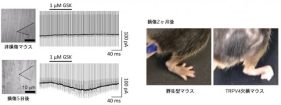 坐骨神経傷害からの回復にTRPV4イオンチャネルが関わることを発見