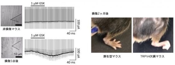 坐骨神経傷害からの回復にTRPV4イオンチャネルが関わることを発見