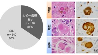 高齢者の1/3はパーキンソン病・レビー小体型認知症及びその予備群で、食道病変は重症度を反映する