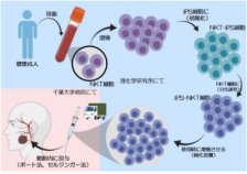 iPS-NKT細胞を活用したがん免疫細胞療法の治験1症例目が終了