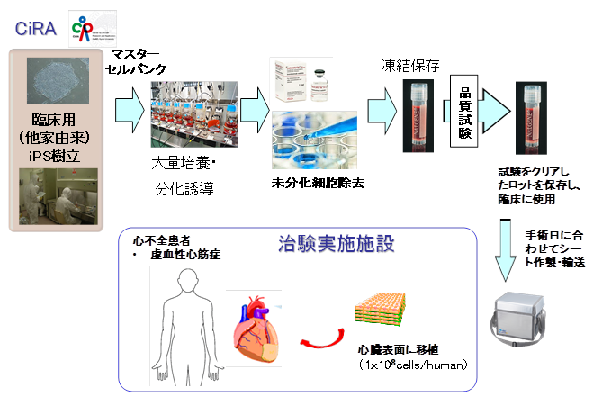 iPS細胞から作製した心筋細胞シートの医師主導治験の実施～治験計画前半の移植実施報告～