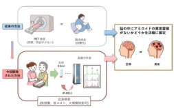 血液検査によるアルツハイマー病変の検出法が製品化され、医療機器承認を取得しました