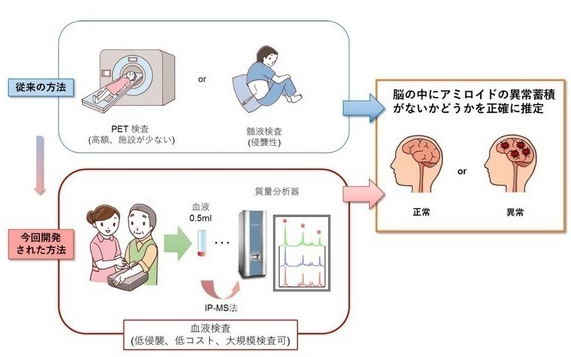血液検査によるアルツハイマー病変の検出法が製品化され、医療機器承認を取得しました