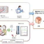 血液検査によるアルツハイマー病変の検出法が製品化され、医療機器承認を取得しました