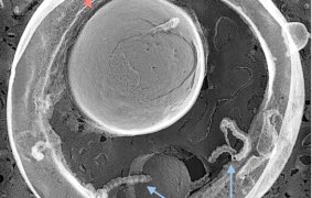 微生物が多様な膜小胞を作る仕組みを解明